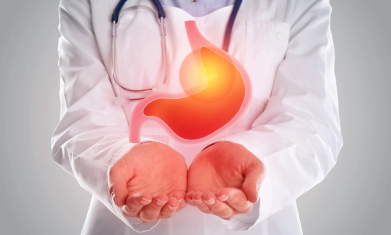 Nutritional Guidelines After Gastric Sleeve Surgery for Optimum Recovery