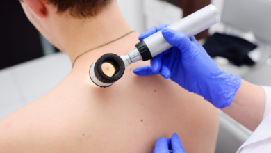 Signs And Risks Of Skin Cancer You Should Know