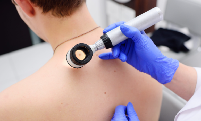 Signs And Risks Of Skin Cancer You Should Know